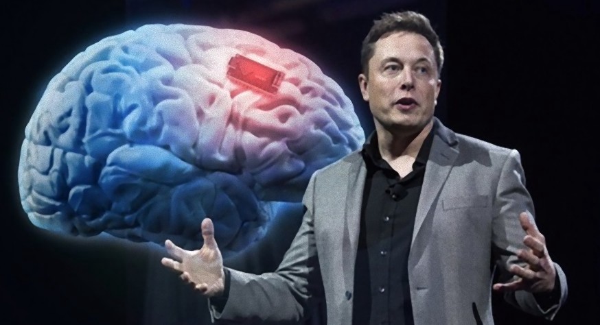 Elon+Musks+Neuralink